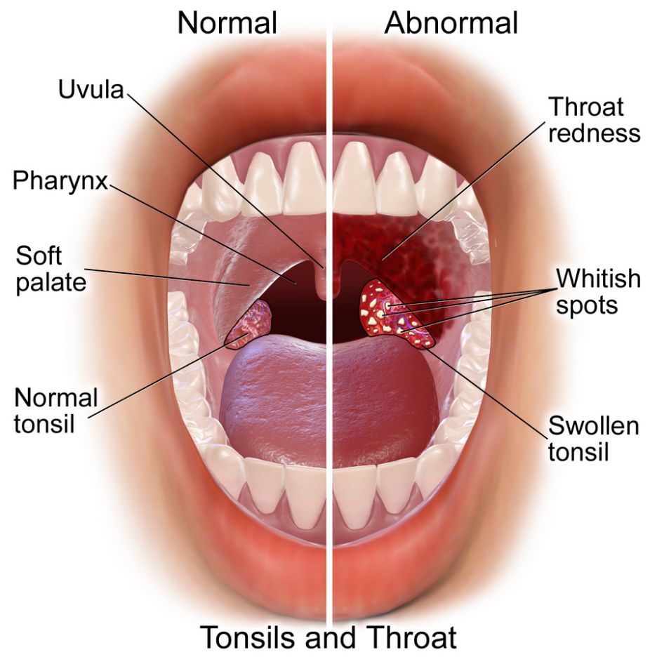 Diagram anatomi tonsil dan tenggorokan